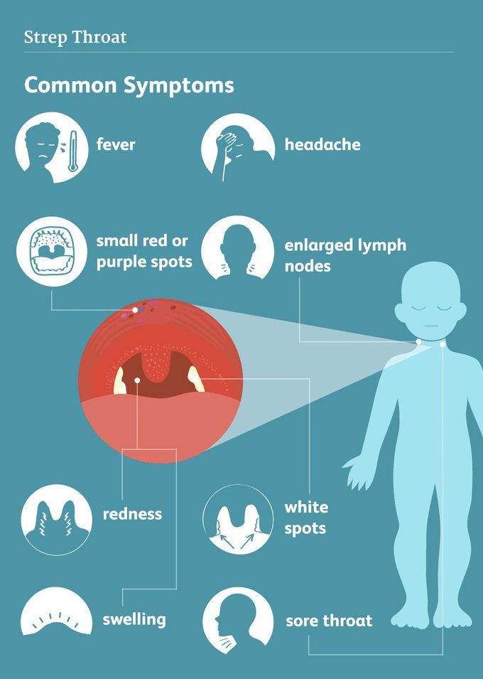 Symptoms of Strep throat