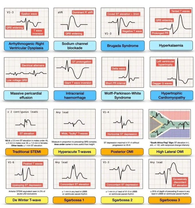 ECG Review