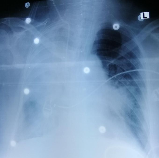 Diagnosis?