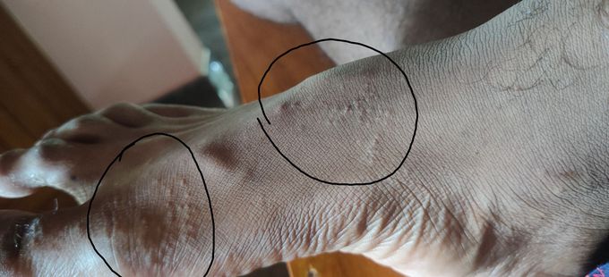 Diagnosis???