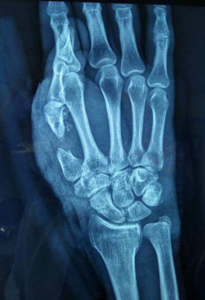 Hand