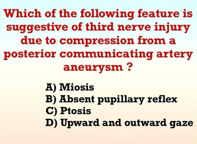 Posterior Communicating Artery Aneurysm