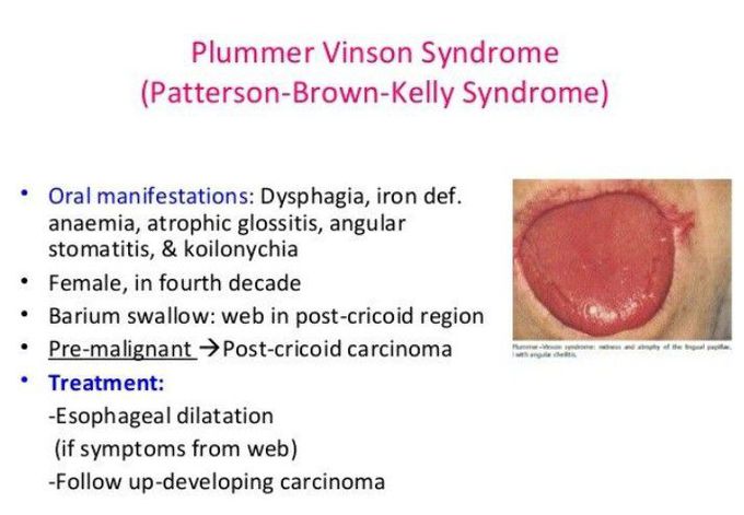 Symptoms of Plummer-Vinson syndrome