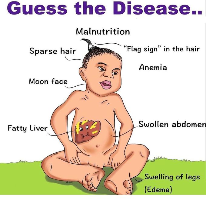Guess the Disease