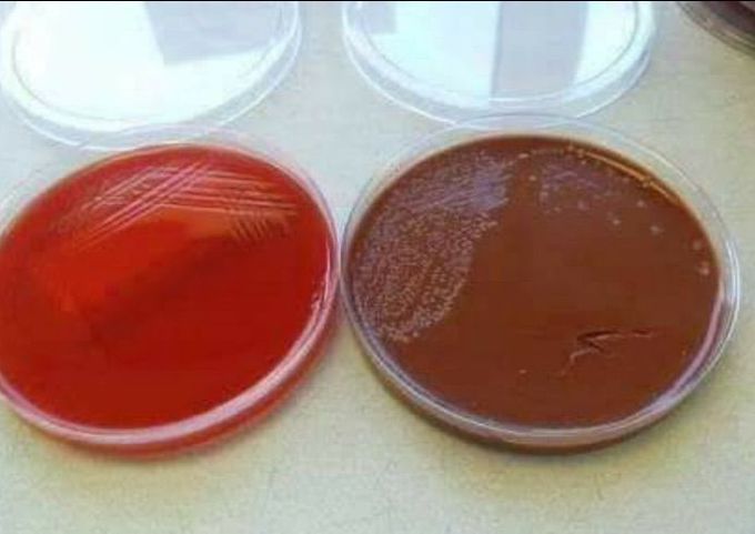 What is the difference between blood agar and chocolate agar despite  that they are contains the same composes ???