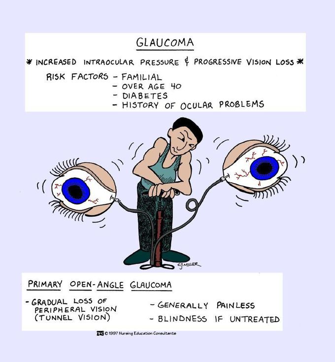 Glaucoma