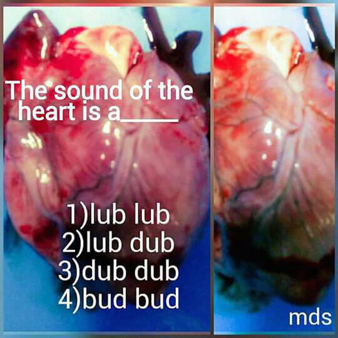 HEART