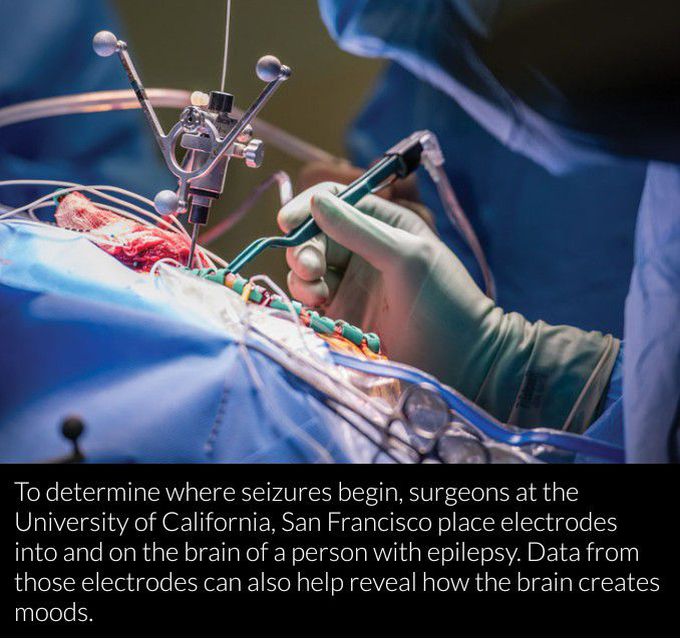 Brain electrodes