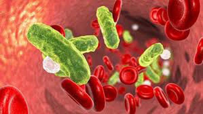 What is Septicemia