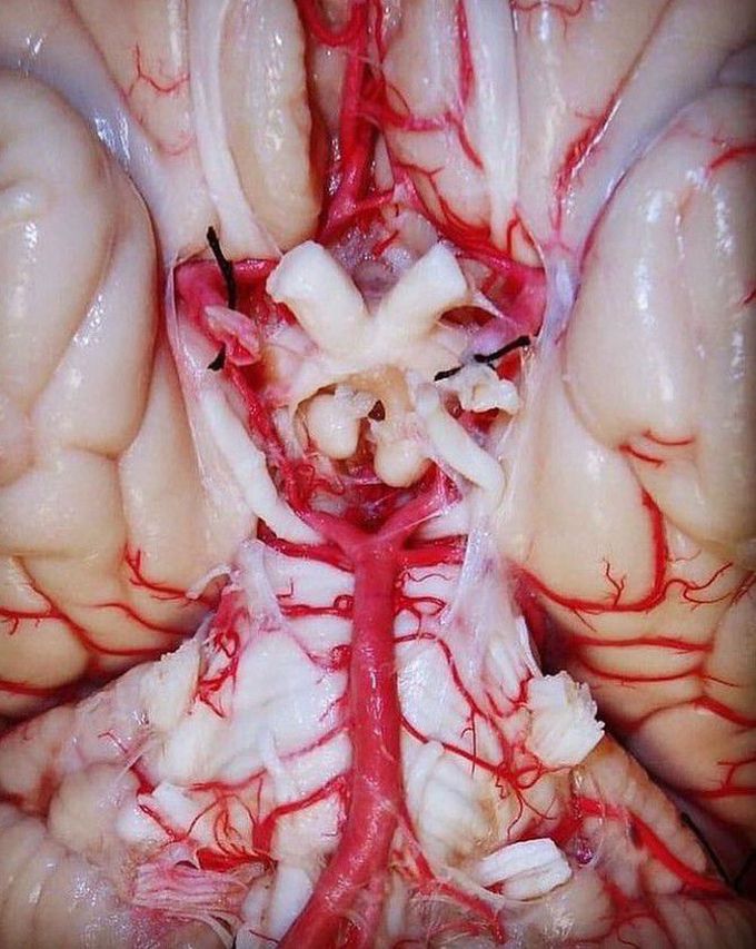 Identify the Structure