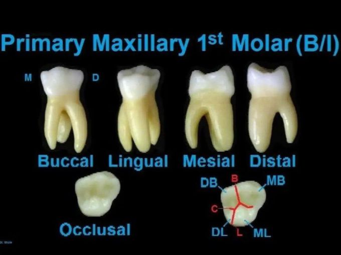 Primary Maxillary 1st Molar - MEDizzy