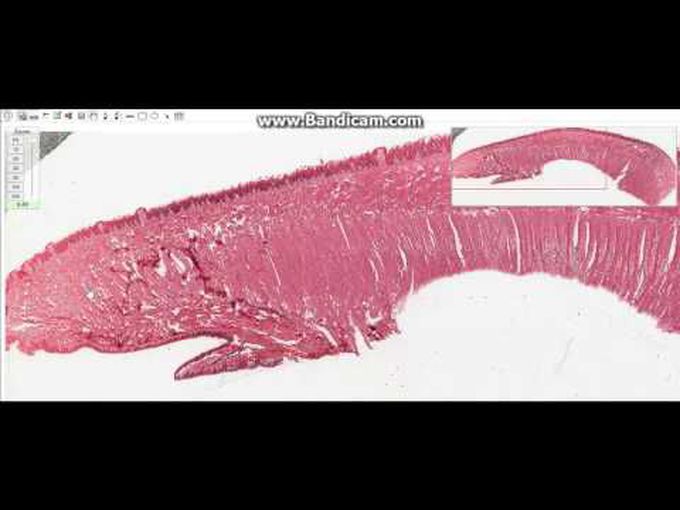 Histology- Tongue