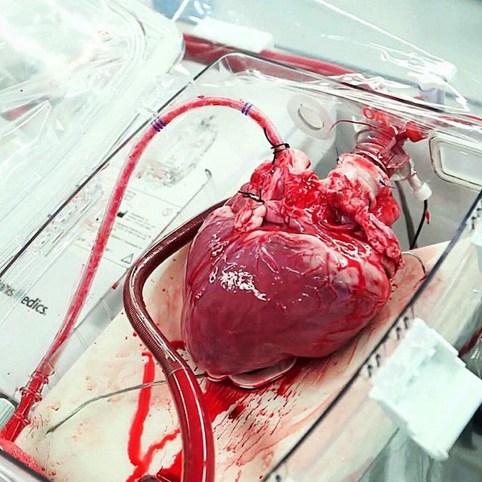 Heart beating outside the body!