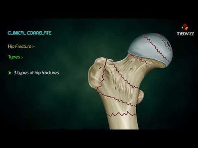 Anatomy Of The Femoral Bone