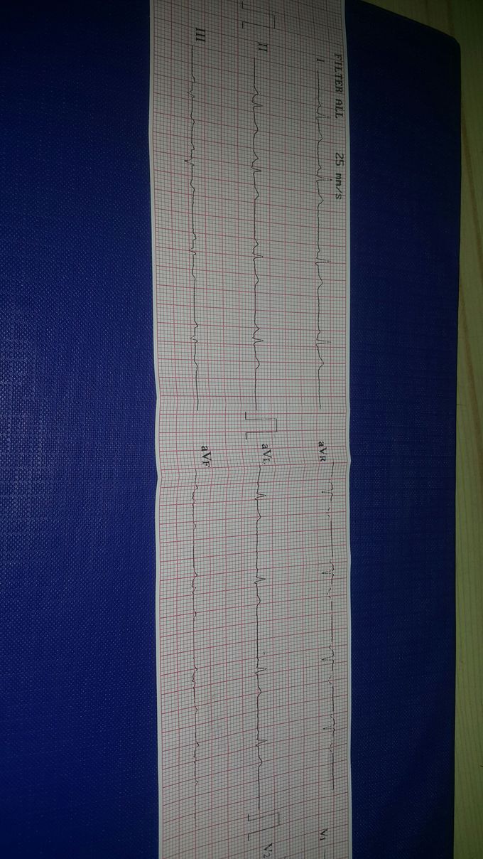 What's your diagnosis