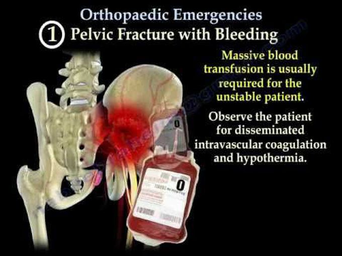 Emergencies in Orthopedic surgery-Part 1