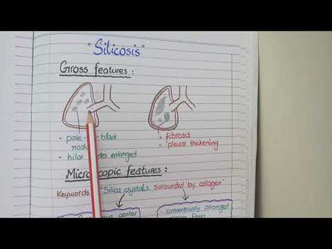 Pathology of Restrictive lung Disease
