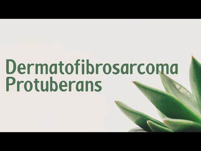 Dermatofibrosarcoma protuberans - DFSP