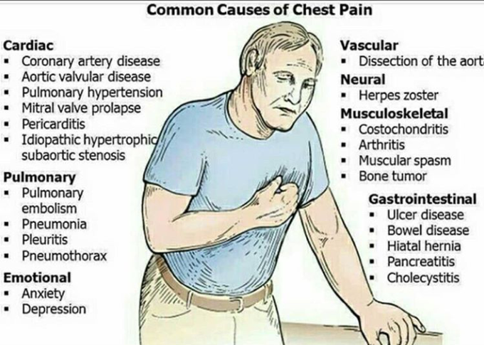 Common Cause For Chest Pain - MEDizzy