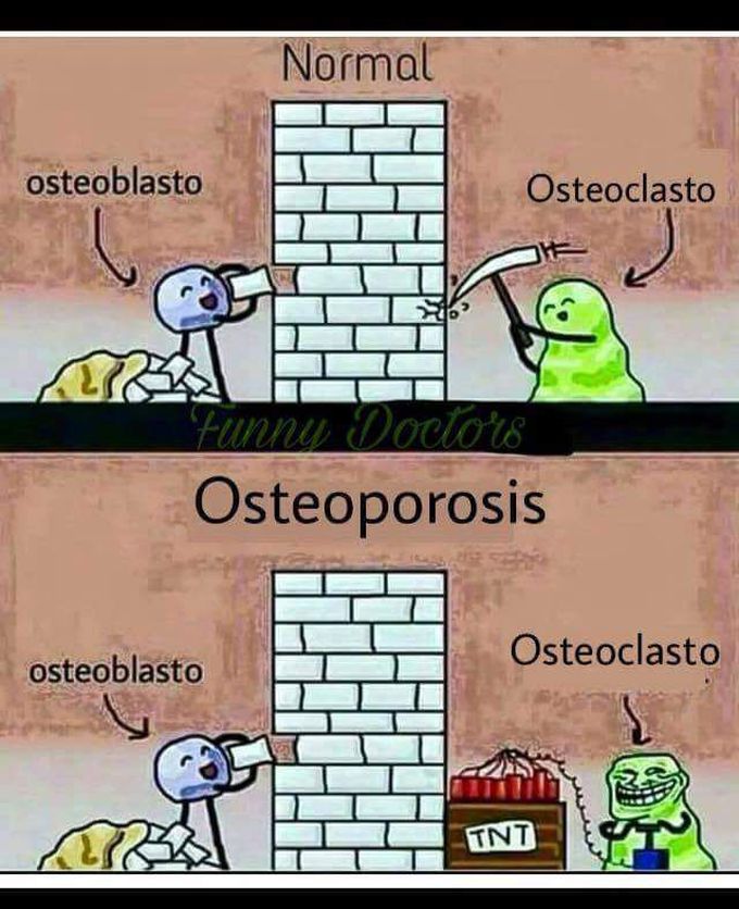 XD