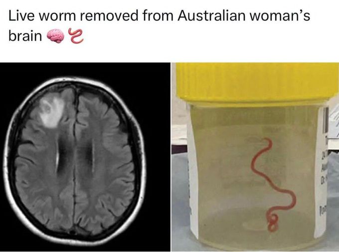 Worm inside the Brain