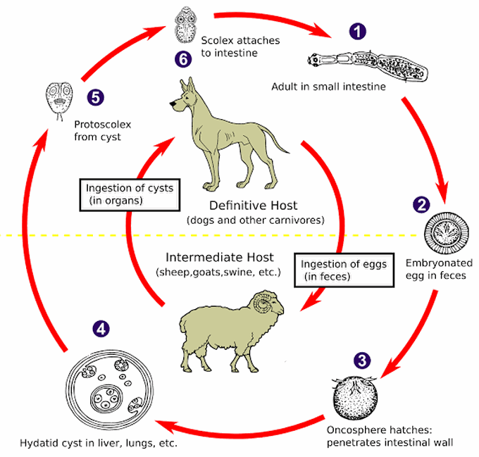 Hydatid disease - MEDizzy