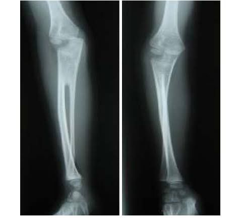 Supination and Pronation - MEDizzy