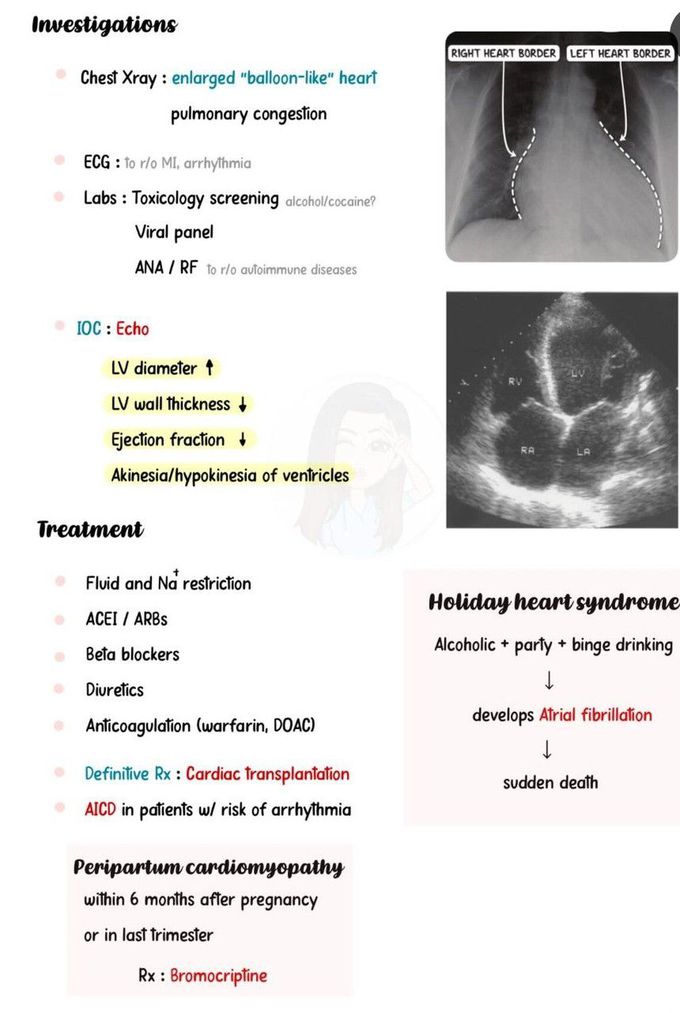 Dilated Cardiomyopathy II