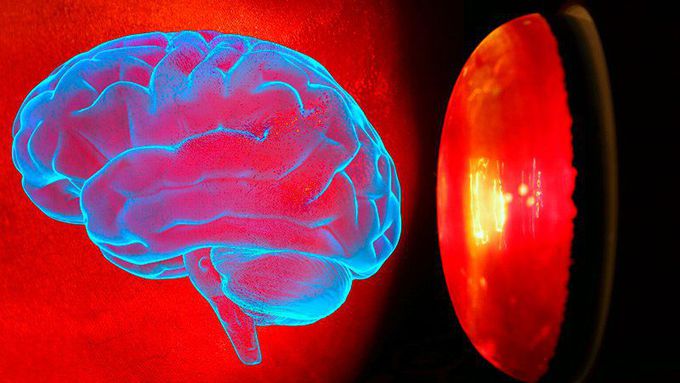 Low-Level Light Therapy Safe for TBI in Humans