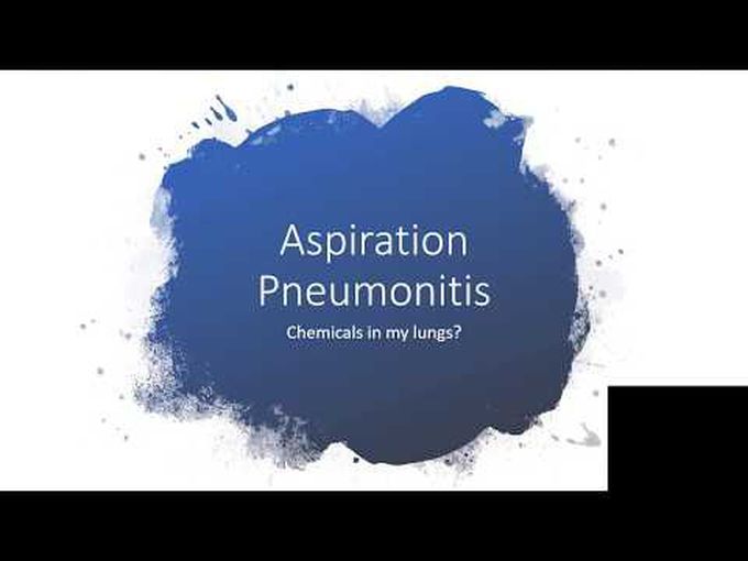 What is Aspiration Pneumonia?