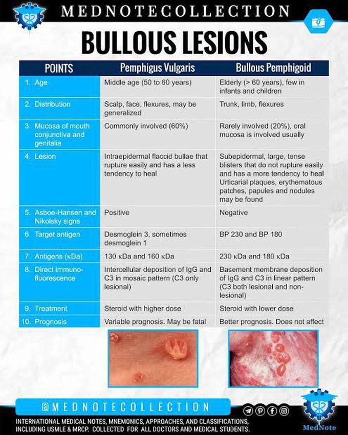 Pemphigus vulgaris vs Bullous Pemphigoid