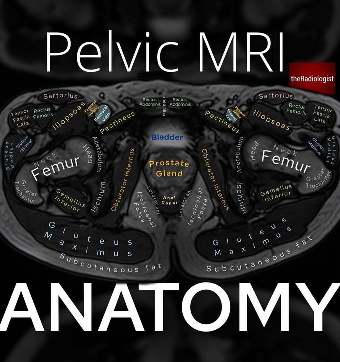 Pelvic MRI