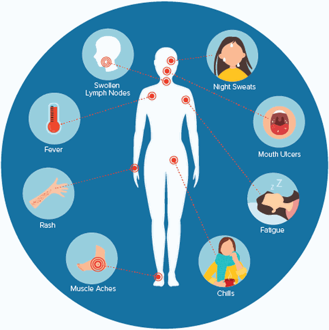 Symptoms of HIV