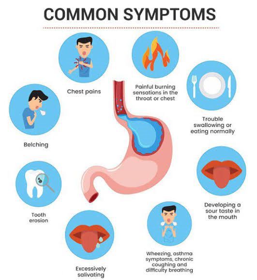 Symptoms Of Gerd MEDizzy