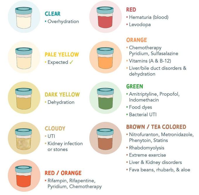 Urine Colors Explained - MEDizzy