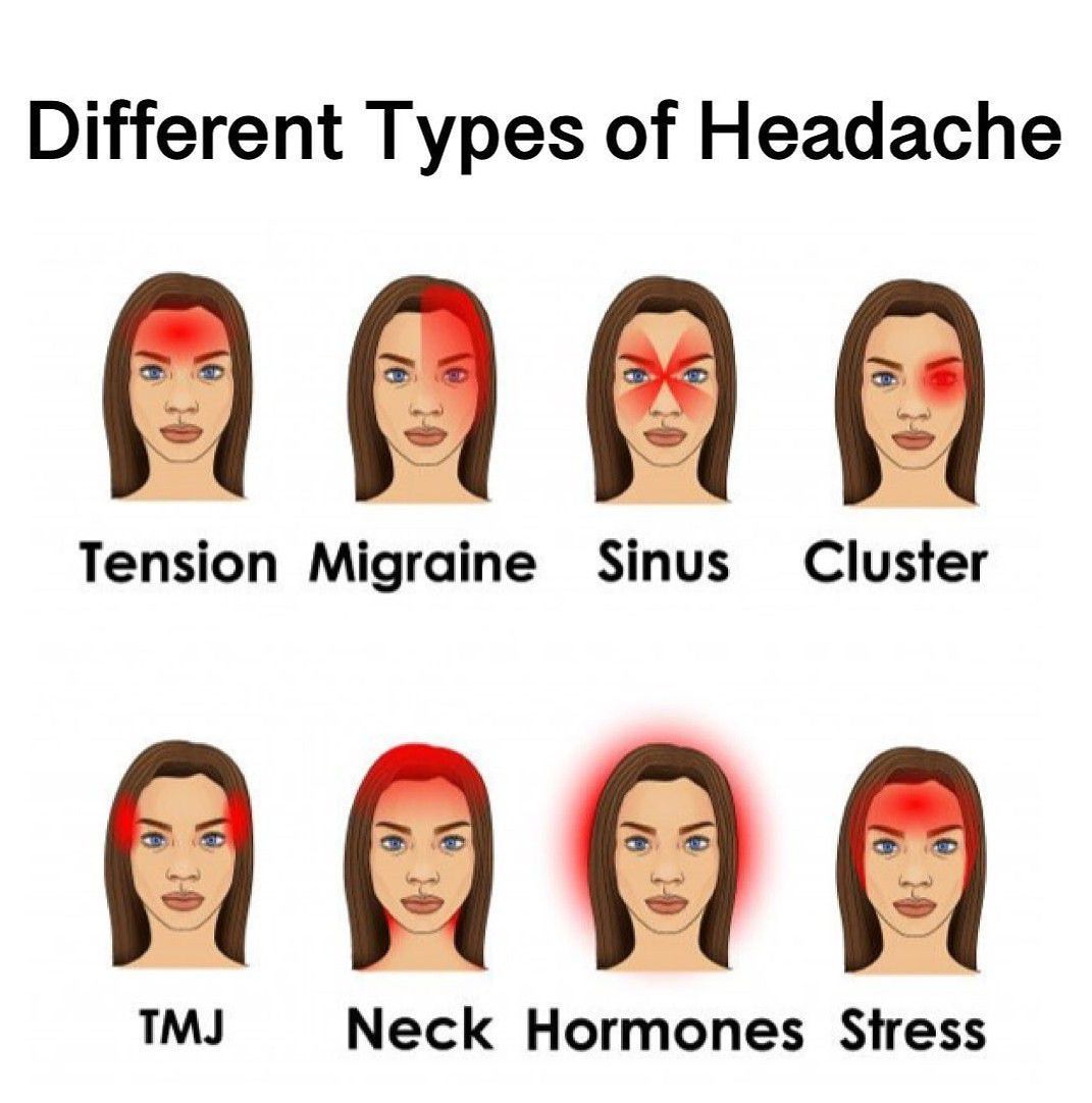 Types of Headache - MEDizzy