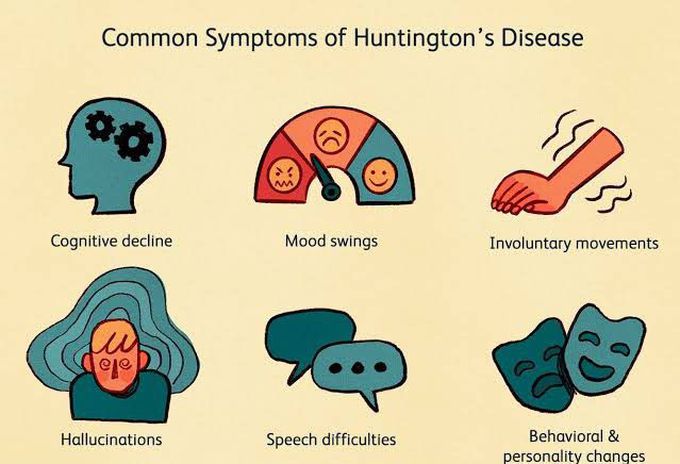Features of huntingtons disease