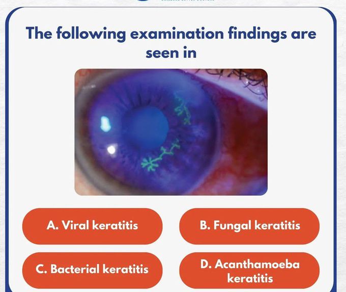 Identify the Keratitis Type