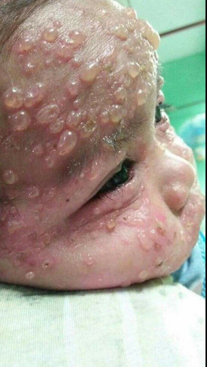 What is this disease called?
