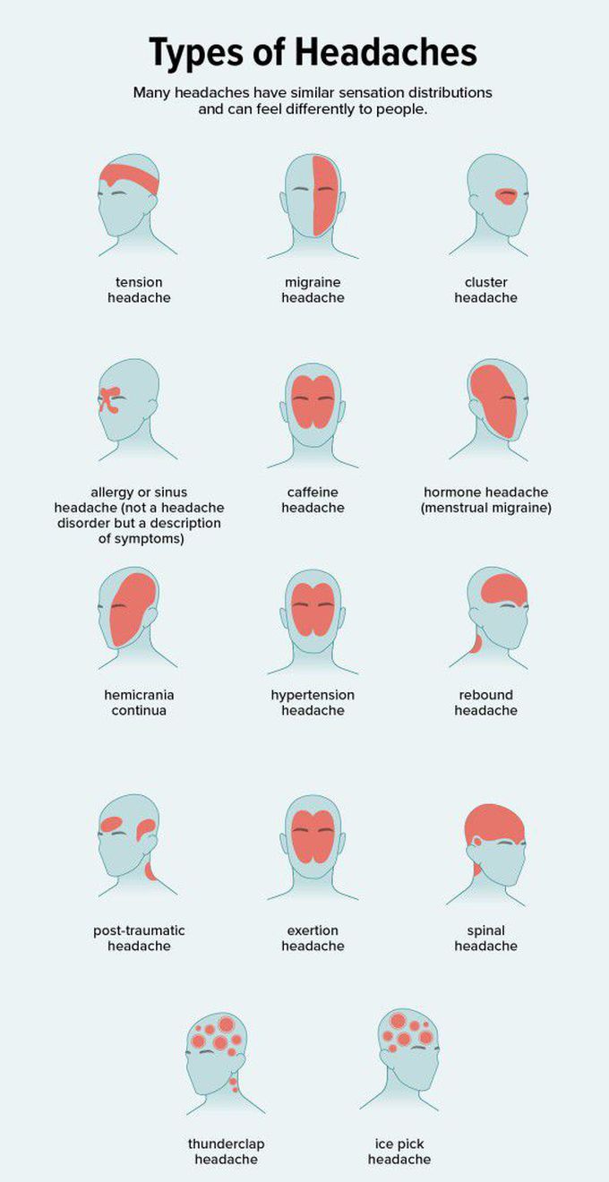 Types of Headaches