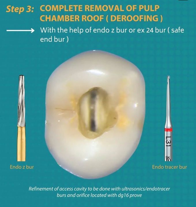 Access Cavity Prep II