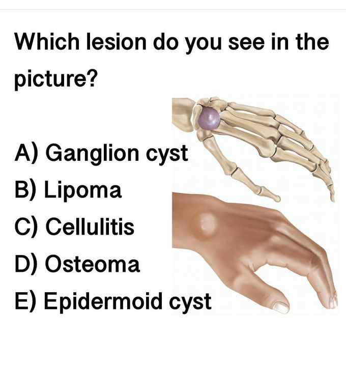 Identify the Condition