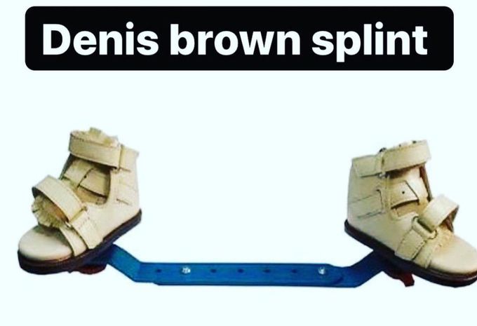 Denis Brown Splint