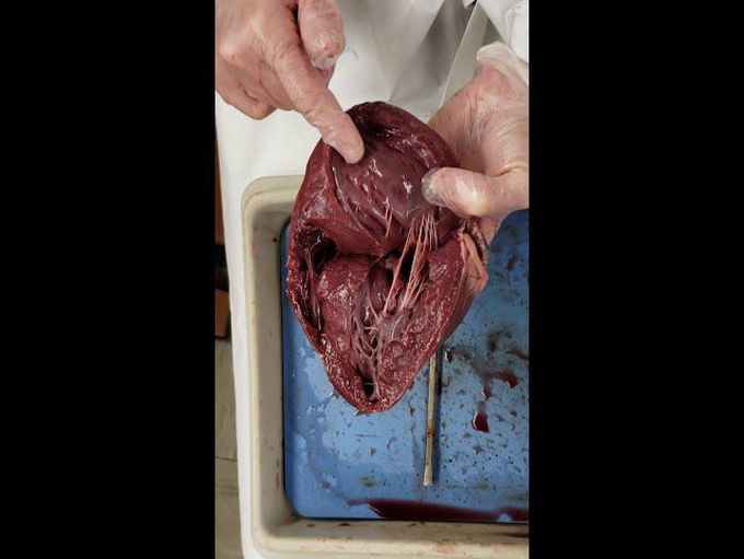 Heart Dissection A &P II Dr. Hicks