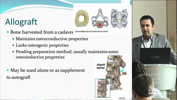 Bone Graft options in Spine Surgery - Noojan Kazemi, MD, FACS