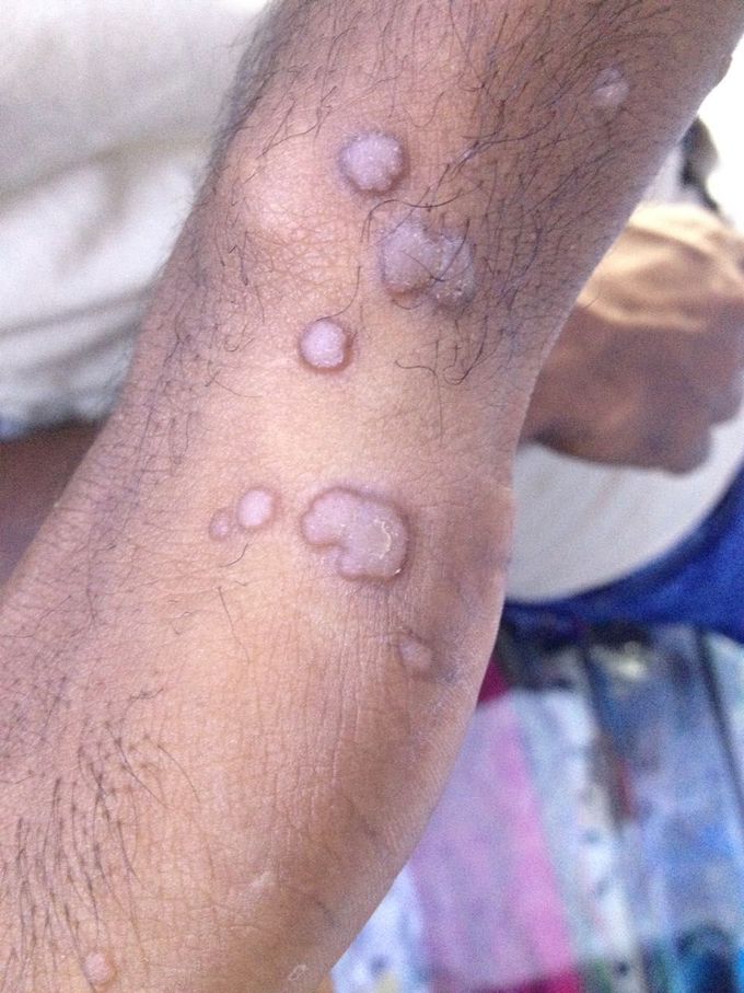 Dx? Rx?