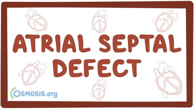 Atrial Septal Defect Explained