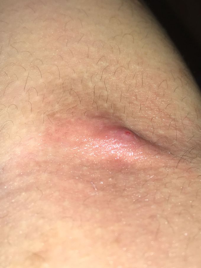 UPDATE TO MY PREVIOUS POST