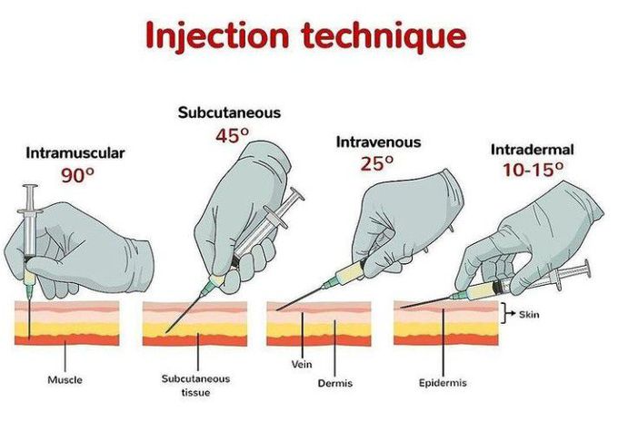Injection technique