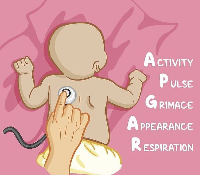 APGAR score in infants